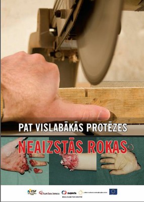 Pat vislabakas protezes neaizstas rokas
